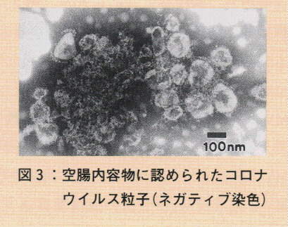 図3.空腸内容物に認められたコロナウイルス粒子