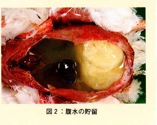 図2.腹水の貯留