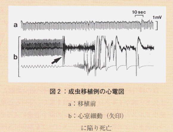 図2.成虫移植例の心電図