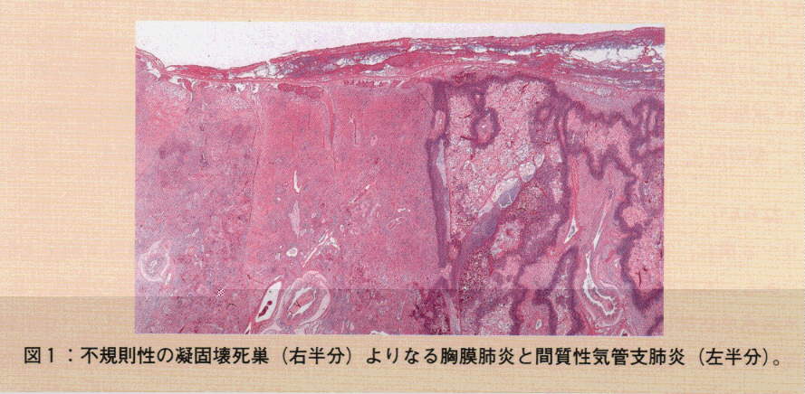 図1.不規則性の凝固懐死巣よりなる胸膜肺炎と間質性気管支肺炎