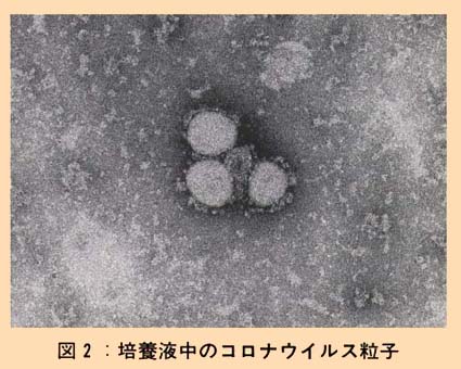 図2 培養液中のコロナウイルス粒子