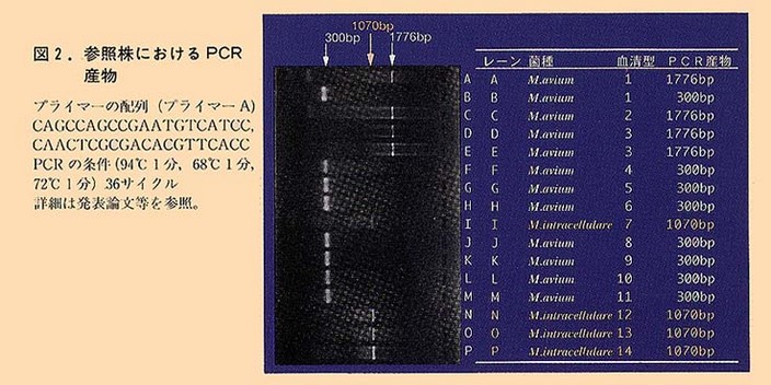 図2 参照株におけるPCR産物