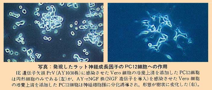 写真 発現したラット神経成長因子のPC12細胞への作用