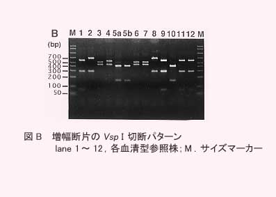 図B.増幅断片のVsp1切断パターン