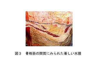 図3.骨格筋の間質にみられた著しい水腫
