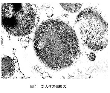 図4 封入体の強拡大