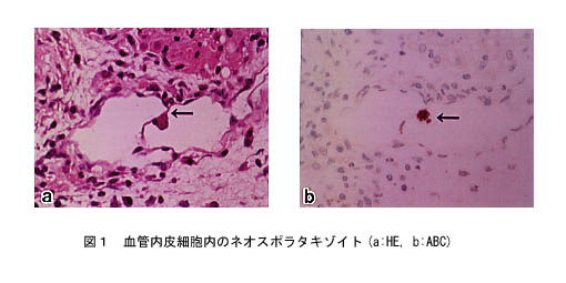 図1 血管内皮細胞内のネオスポラタキゾイト
