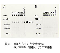 図2 mAbをもちいた免疫蛍光:(A)COSbKit細胞と(B)COS細胞