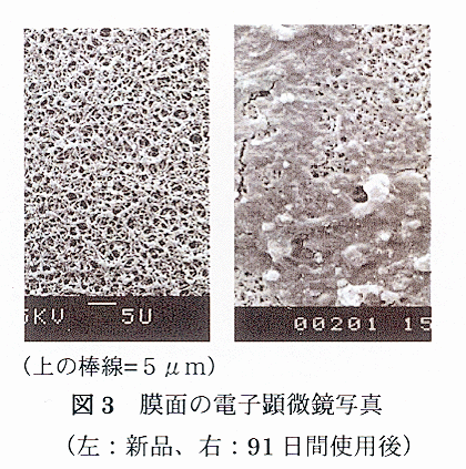 図3 膜面の電子顕微鏡写真
