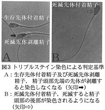 図3 トリプルステイン染色による判定基準