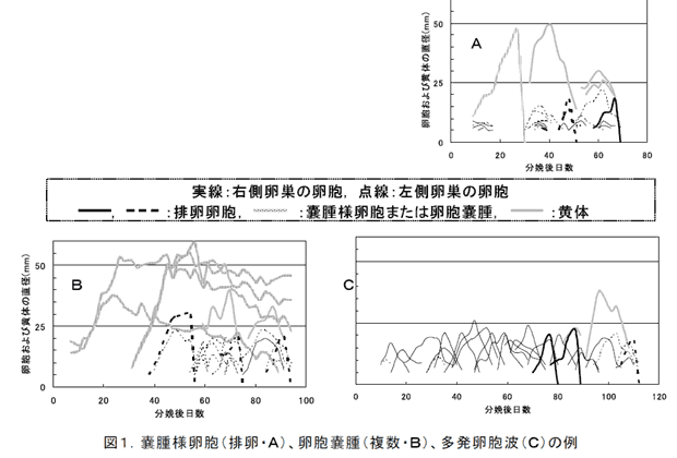 図1.嚢腫様卵胞(排卵・A)、卵胞嚢腫(複数・B)、多発卵胞波(C)の例