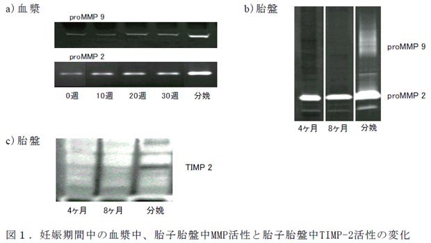 図1.妊娠期間中の血漿中、胎子胎盤中MMP活性と胎子胎盤中TIMP-2活性の変化