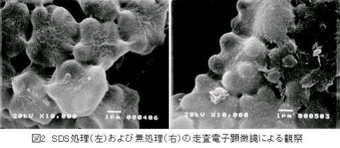 図2.SDS処理(左)および無処理(右)の走査電子顕微鏡による観察