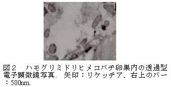 図2  ハモグリミドリヒメコバチ卵巣内の透過型電子顕微鏡写真