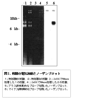 図1. 核酸の電気泳動とノーザンブロット
