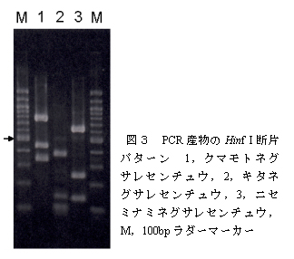 図3 PCR産物のHinf I断片パターン