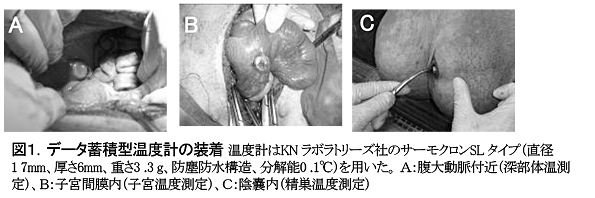 図1.データ蓄積型温度計の装着