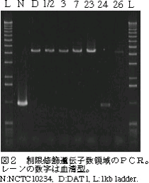 図2 制限修飾遺伝子数領域のPCR