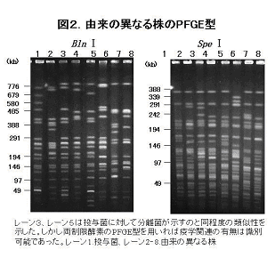 図2 由来の異なる株のPFGE型