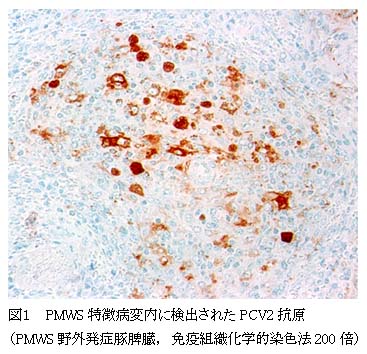 図1 PMWS特徴病変内に検出されたPCV2抗原(PMWS野外発症豚脾臓、免疫組織化学的染色法200倍)