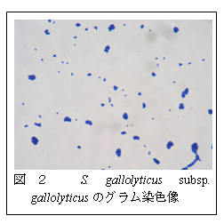 図2 S. gallolyticus subsp. gallolyticusのグラム染色像