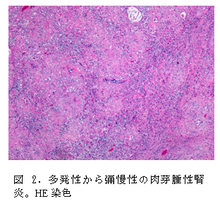 図2. 多発性から彌慢性の肉芽腫性腎炎。