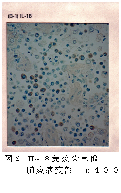 図2 IL-18免疫染色像