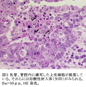 図3 乳管。管腔内に壊死した上皮細胞が脱落している。それらには好酸性封入体(矢印)がみられる。Bar=50μm、HE染色。