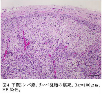 図4 下顎リンパ節。リンパ濾胞の壊死。Bar=100μm、HE染色。