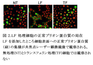 図 2.LF 処理細胞の正常プリオン蛋白質の局在