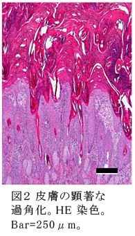 図2 皮膚の顕著な過角化。HE染色。Bar=250μm。