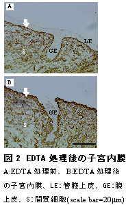 図2 EDTA 処理後の子宮内膜