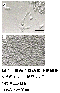 図3 培養子宮内膜上皮細胞