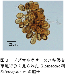図3 アズマネザサ・ススキ優占 草地で多く見られたGlomaceae 科 Sclerocystis sp.の胞子