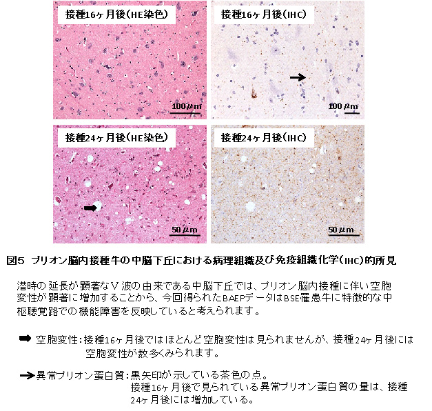 図5.プリオン脳内接種牛の中脳下丘における病理組織及び免疫組織化学(IHC)的所見