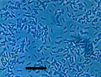 サツマイモから分離した内生窒素固定細菌Klebsiella oxytoca(バーの長さ10µm)